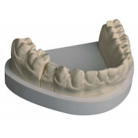 Primus ivory 25 kg Special die stone, type 4